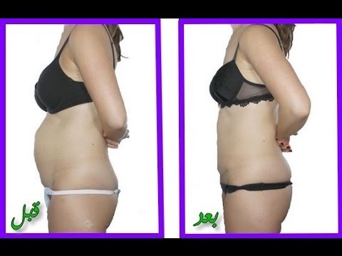 وصفة مغربية لشد ترهلات البطن والتخلص منها تماما