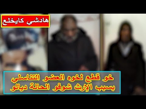 شاهد مغربي يعتدي على زوجته ويتسبب لها بجروح خطيرة
